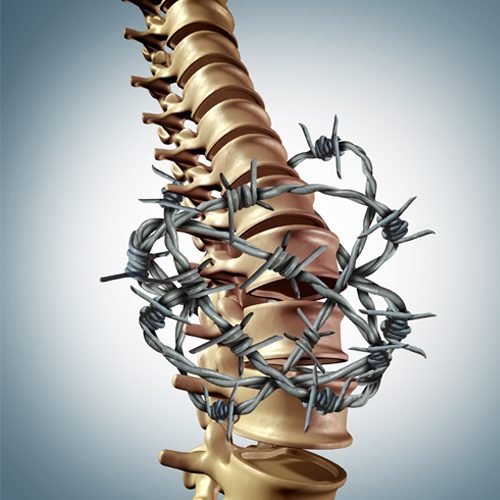Chiropractic North Richland Hills TX Barbed Wire Spine Pain